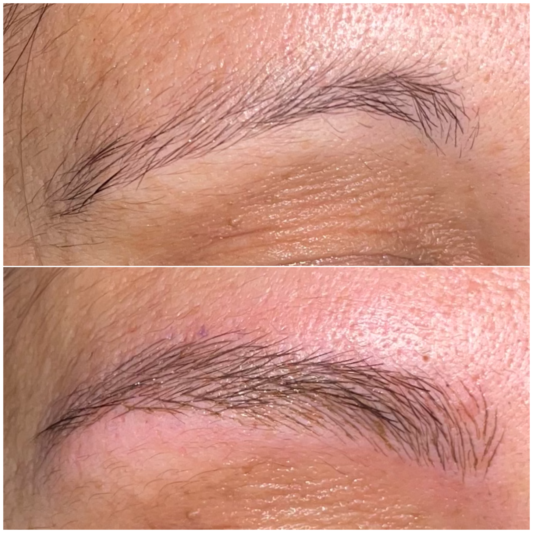 Cejas · Forma y definición