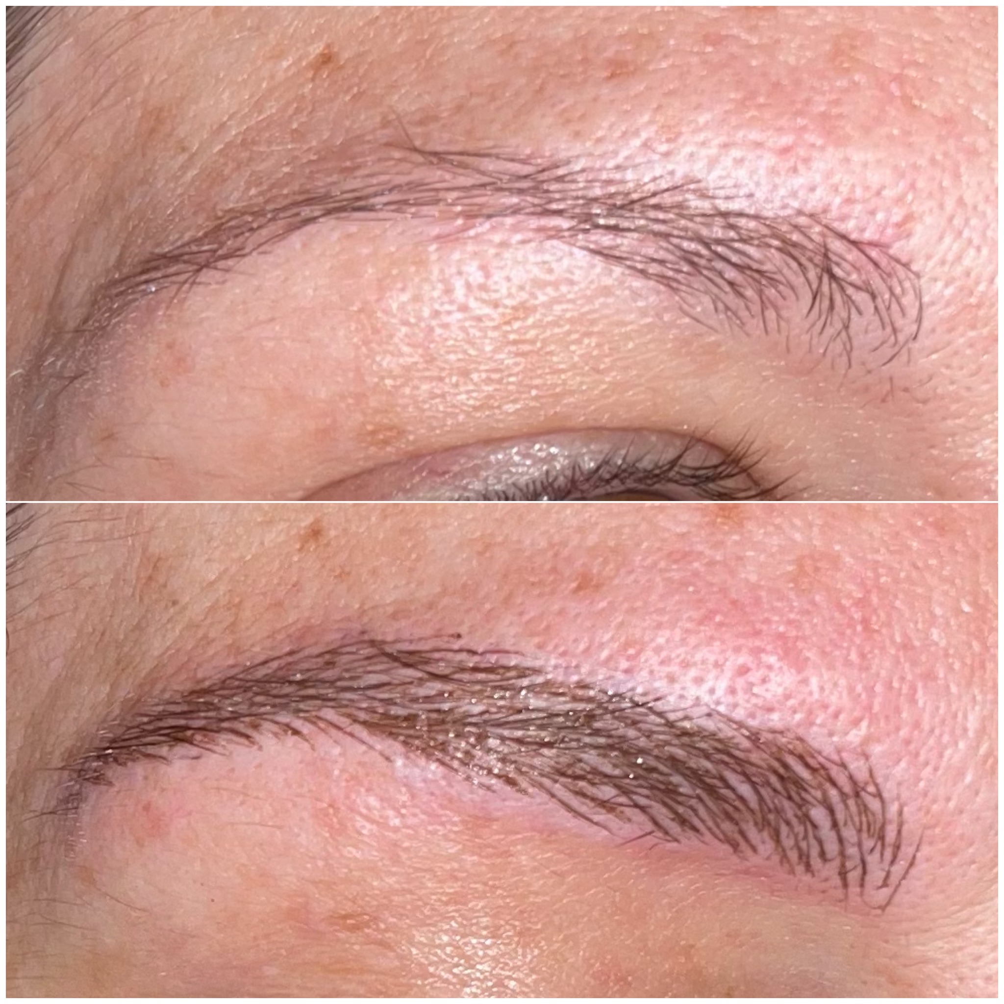 Cejas · Definición del arco